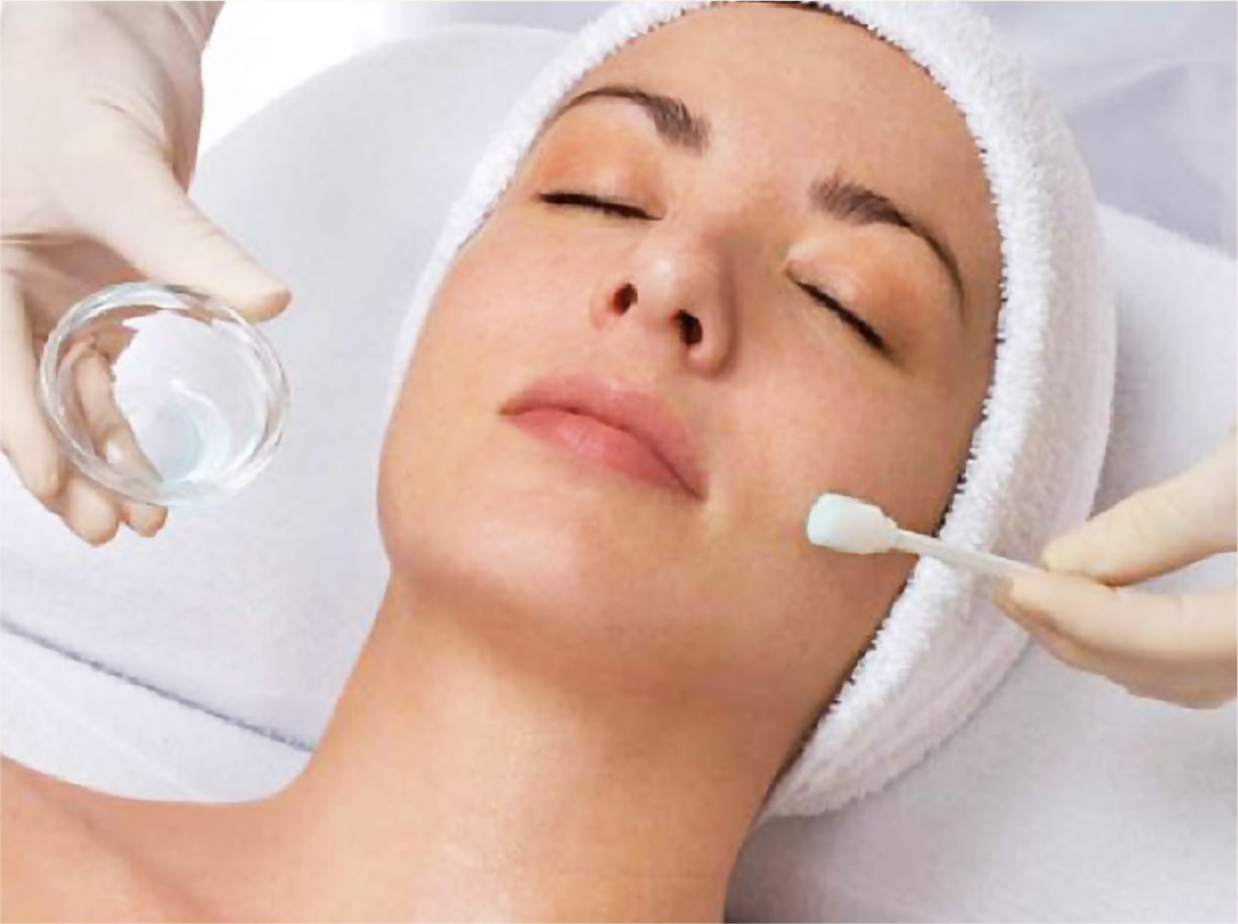 Needling